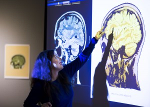 Daisy Patton puts her degenerative disease, MS, on display when she turns her brain scans into art she calls "deterioration" at EvCC. 