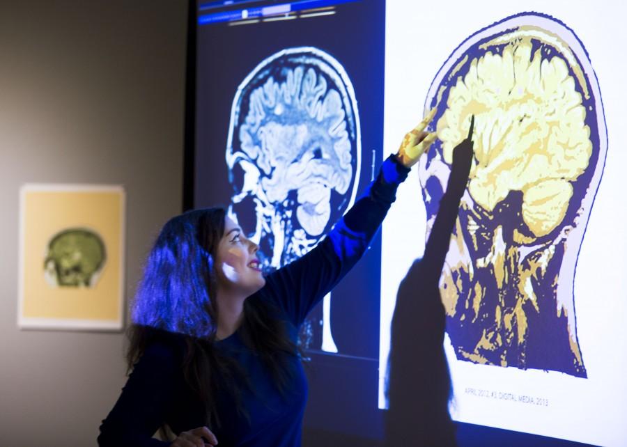 Daisy Patton puts her degenerative disease, MS,  on display when she turns her brain scans into art she calls deterioration at EvCC. 