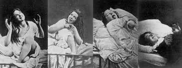 Women with hysteria under the effects of hypnosis.